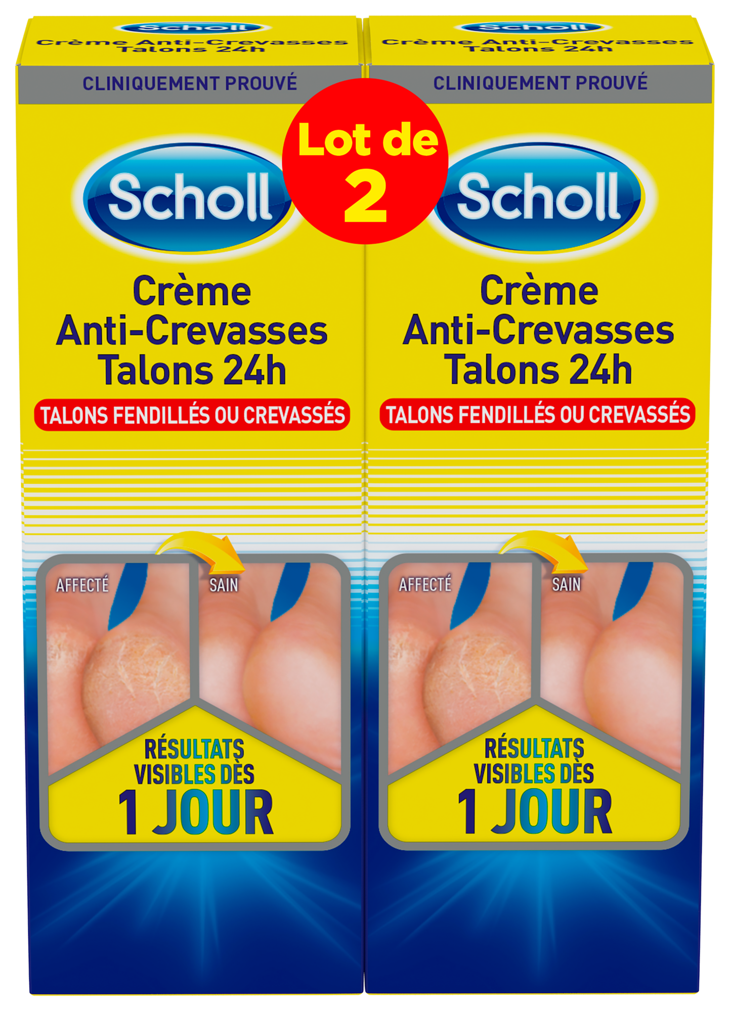 CRÈME ANTI-CREVASSES