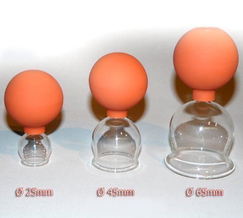 Ventouses 3 en Lot 25-45-65 avec poire à pipete...